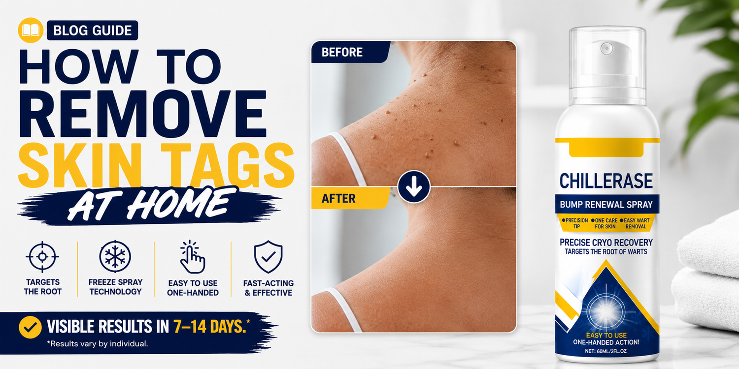 How to Remove Skin Tags at Home: A Simple Guide