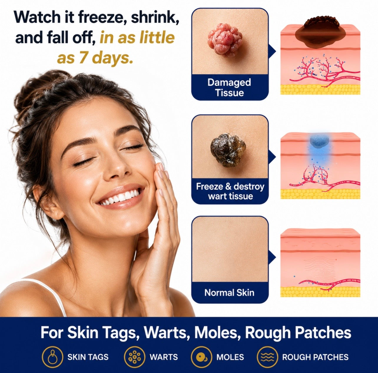 Frost™ ChillErase Bump Renewal spray