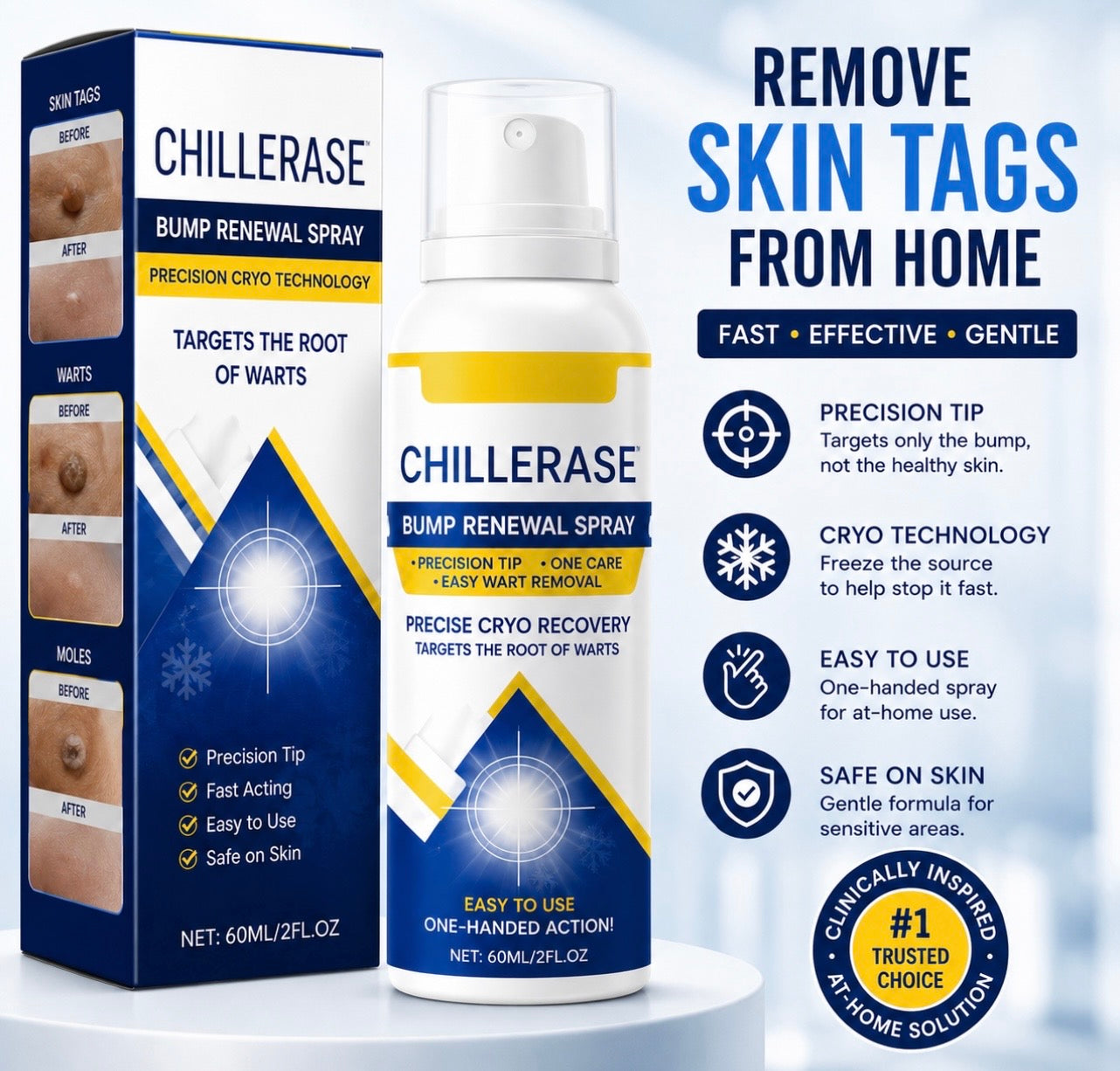 Skin Tag Removal