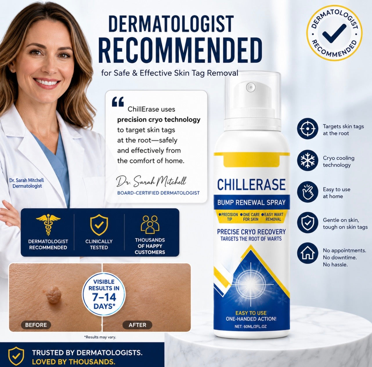Skin Tag Removal