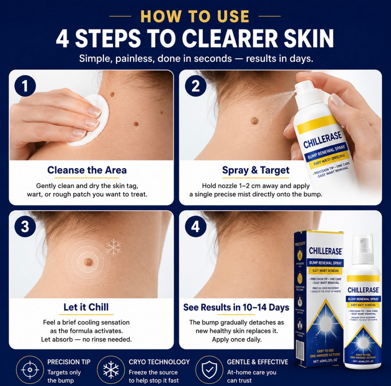 Frost™ ChillErase Bump Renewal spray