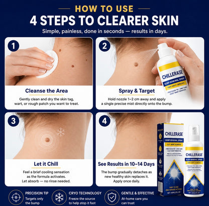 Frost™ ChillErase Bump Renewal spray