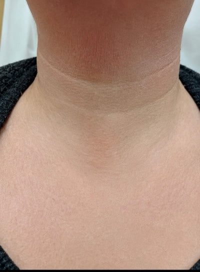 After